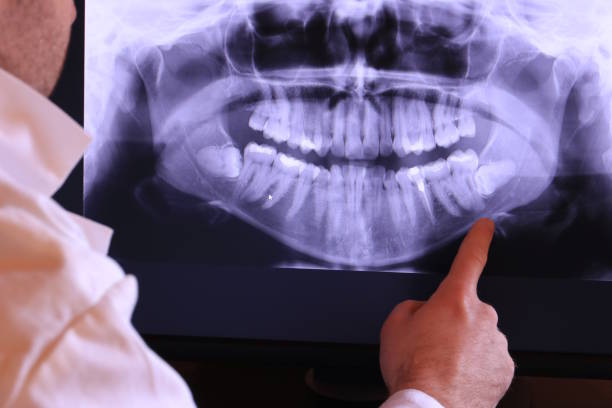 Best Emergency Dental Care for Broken or Chipped Teeth in Pineville, NC