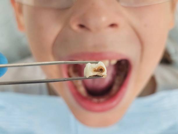 Best Same-Day Emergency Dental Services in Pineville, NC