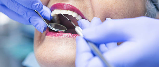 Best Emergency Treatment for Dental Infections or Abscesses in Pineville, NC